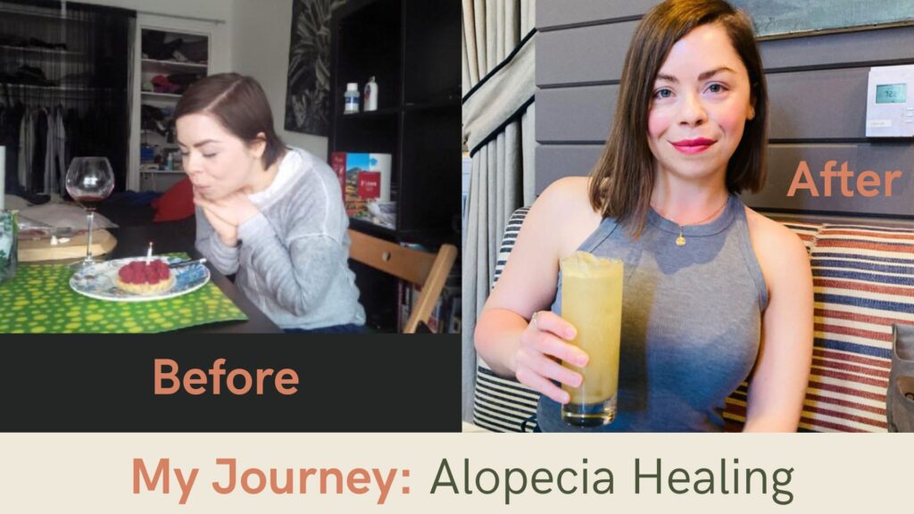 Alopecia & the Radiation Connection